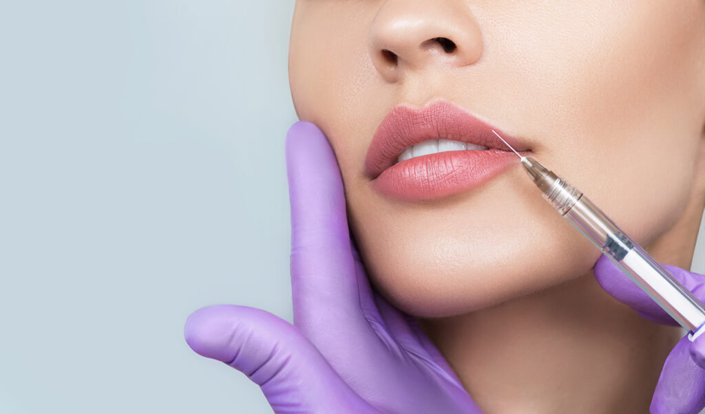Juvederm-Ultra-XC