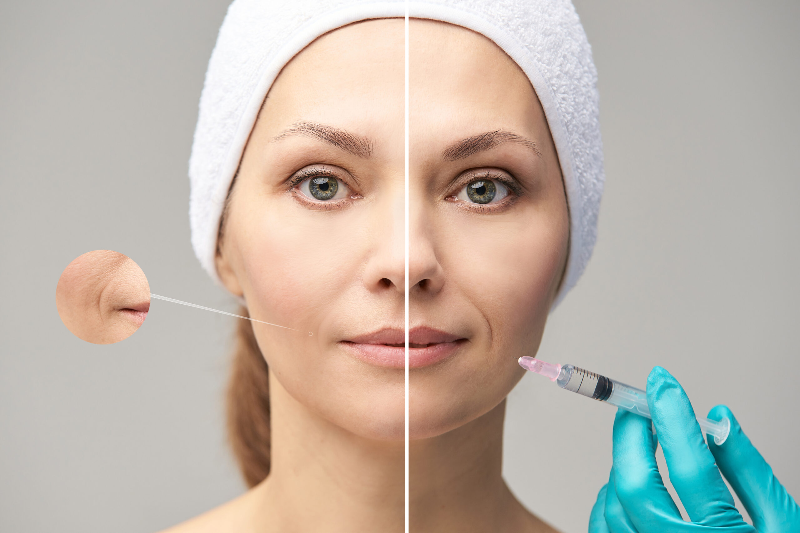 Dermal filler treatments