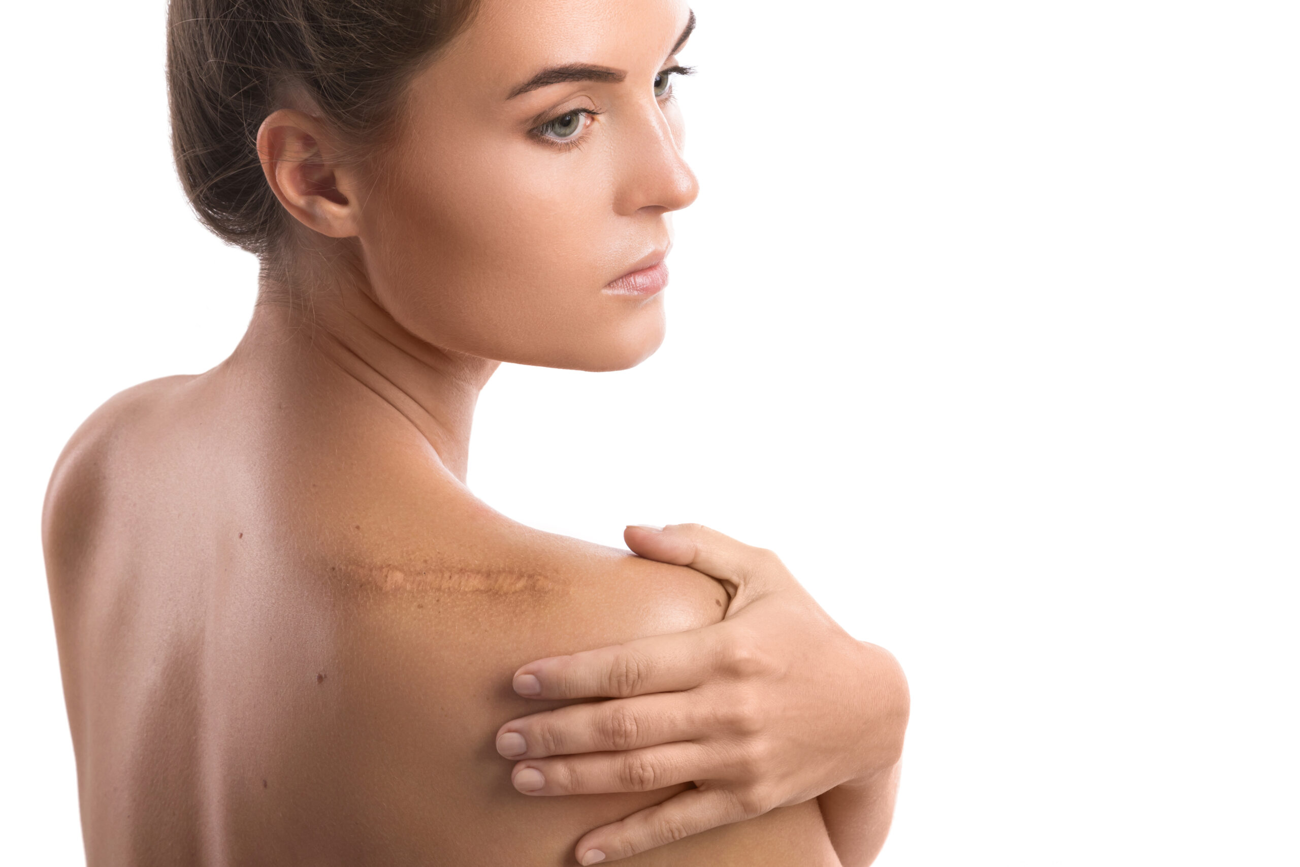 Scar treatments
