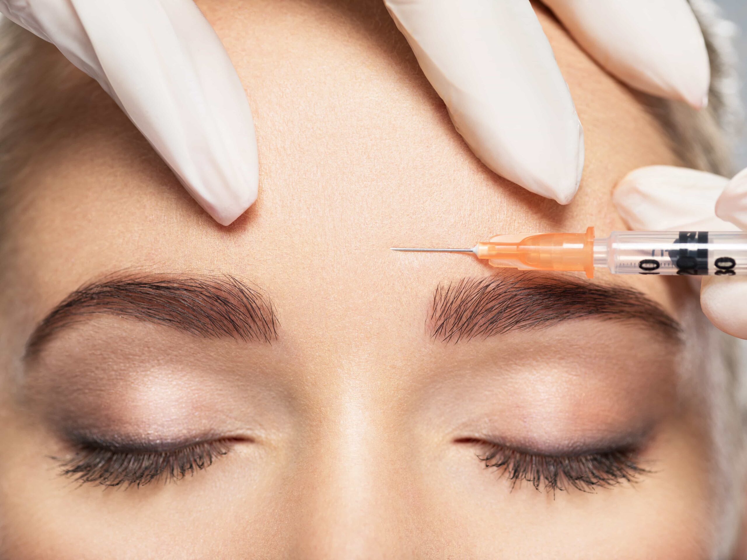 botox for wrinkles