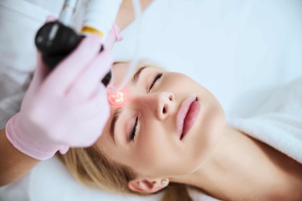 skin resurfacing treatments