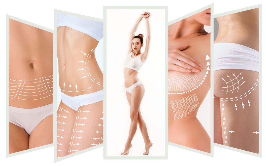 cosmetic surgical procedures