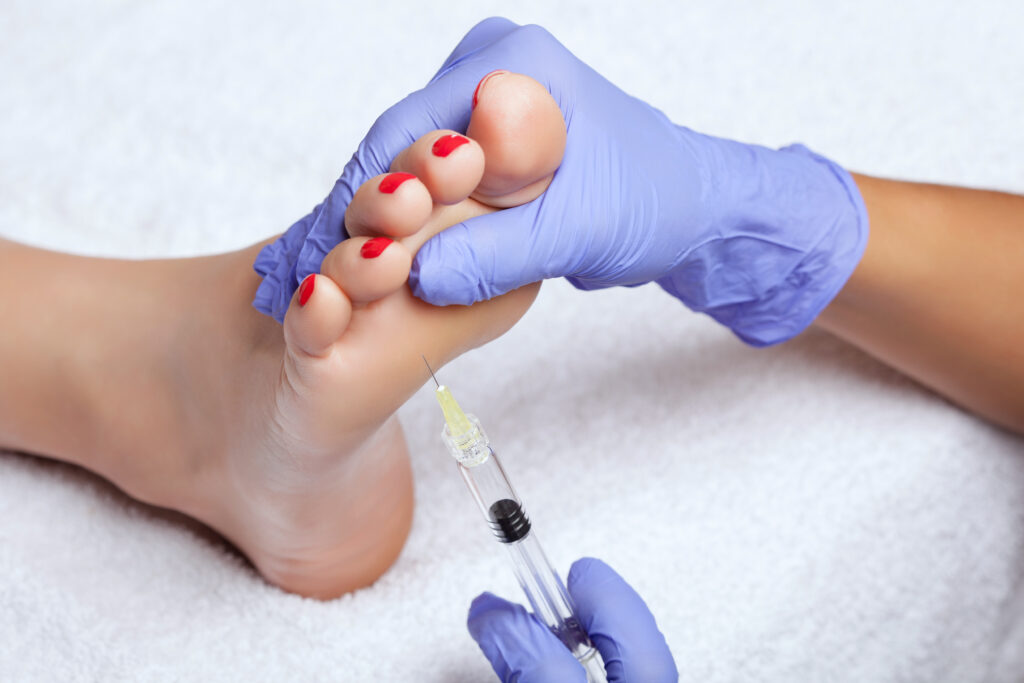 botox for plantar fasciitis