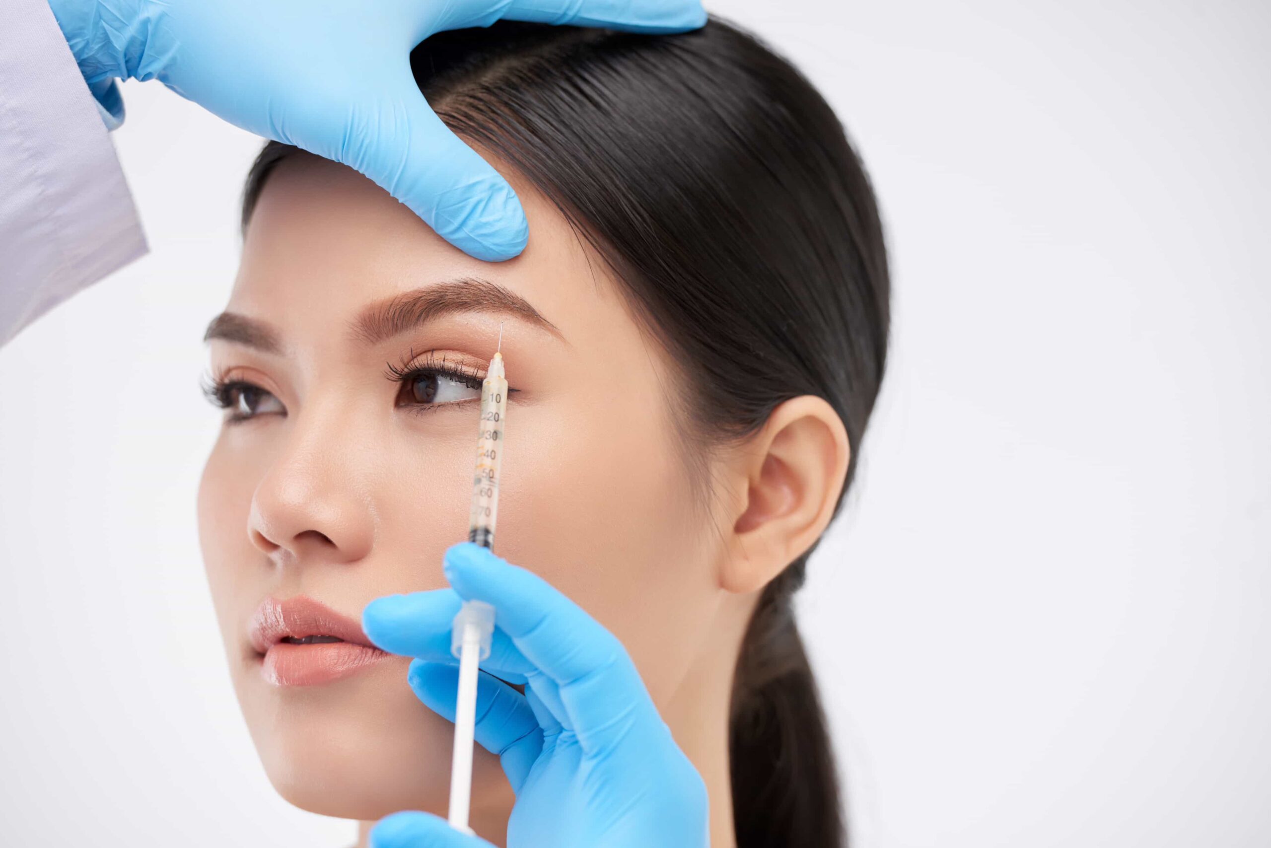 chemical brow lift with botox
