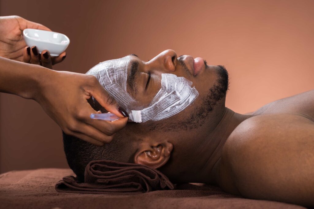 chemical peel