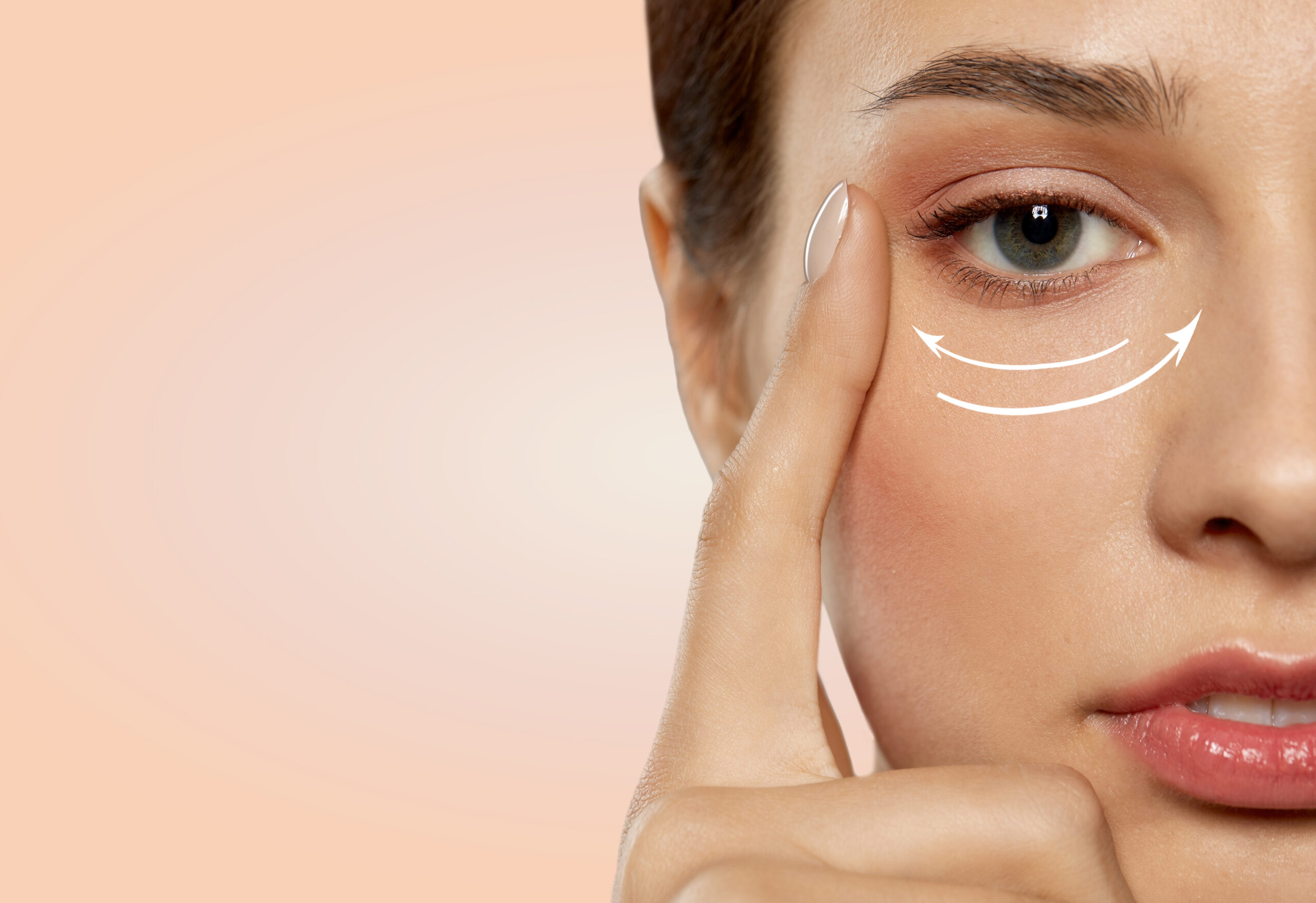 Tear trough filler