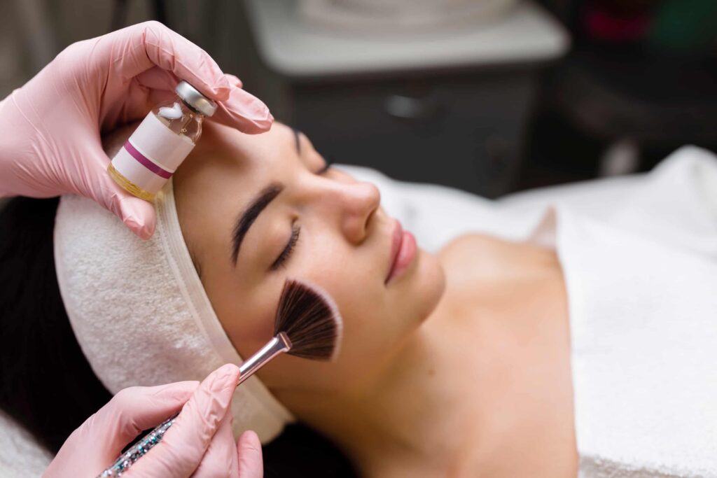 reve chemical peel for melasma