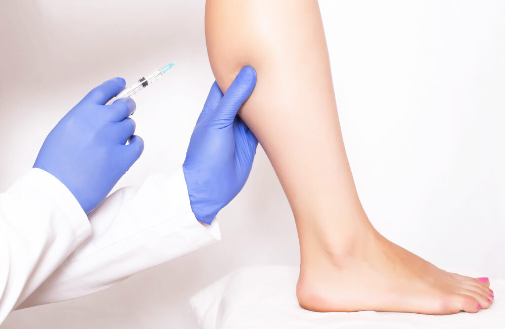 calf botox injections