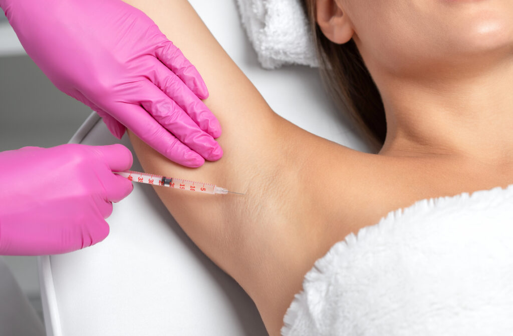 hyperhidrosis botox treatment