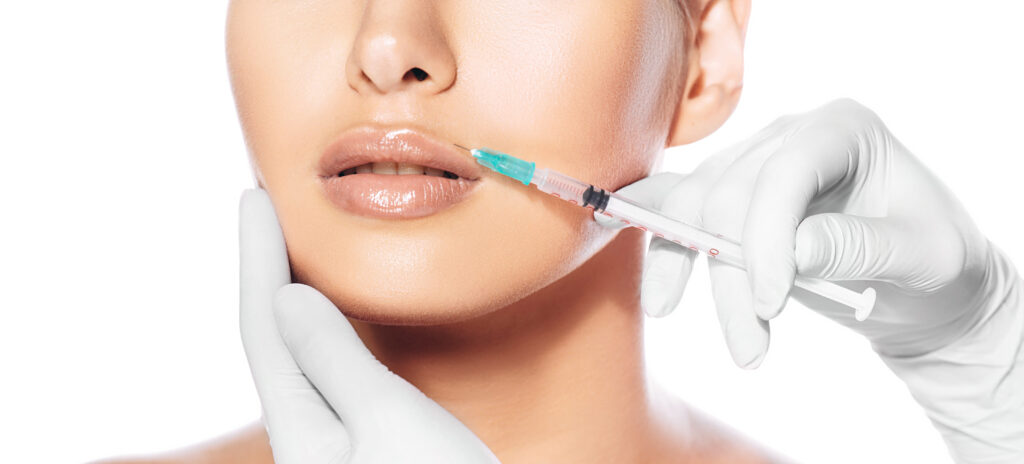 Lip filler