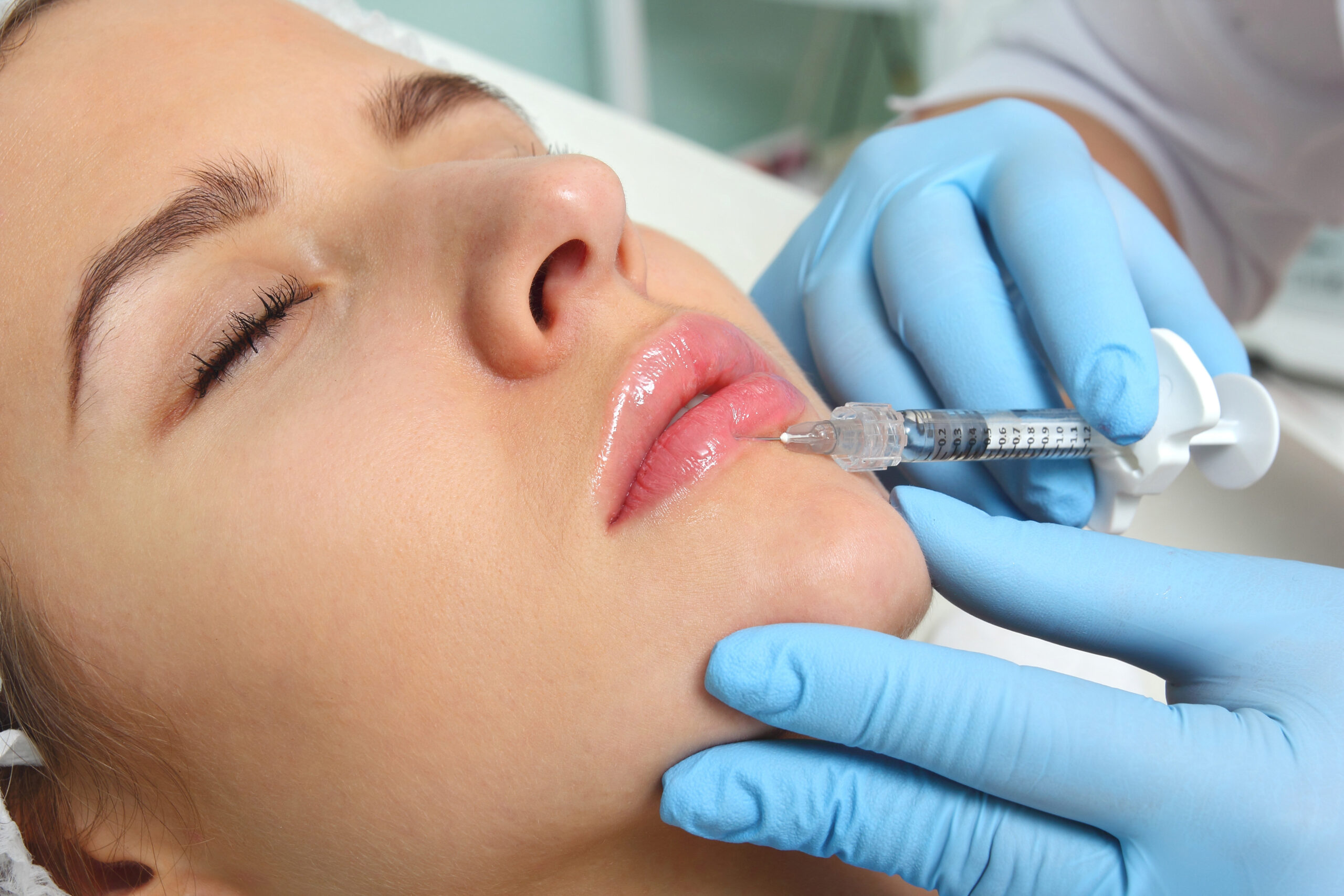 Versa filler