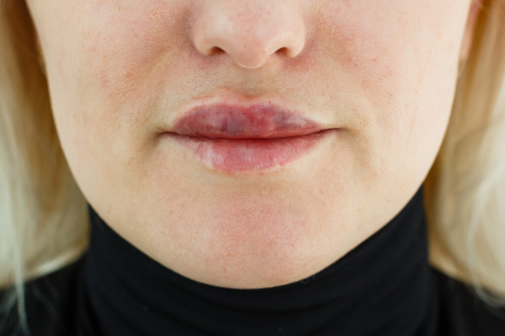 Aesthetic complications and answers