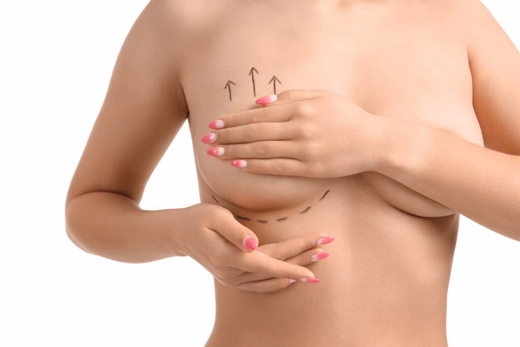 breast lift