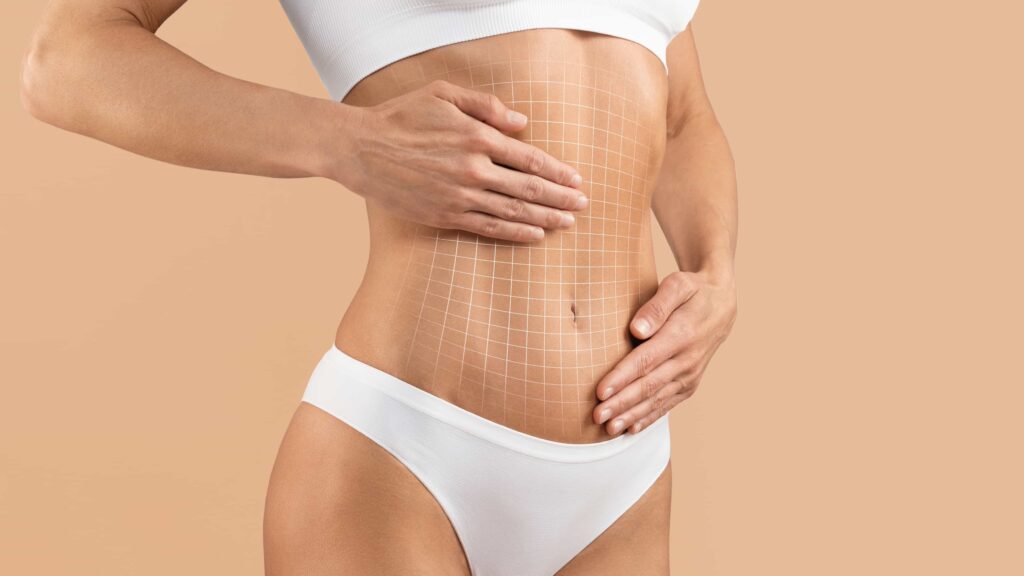 tummy tuck surgery