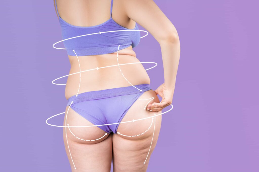 body contouring surgery