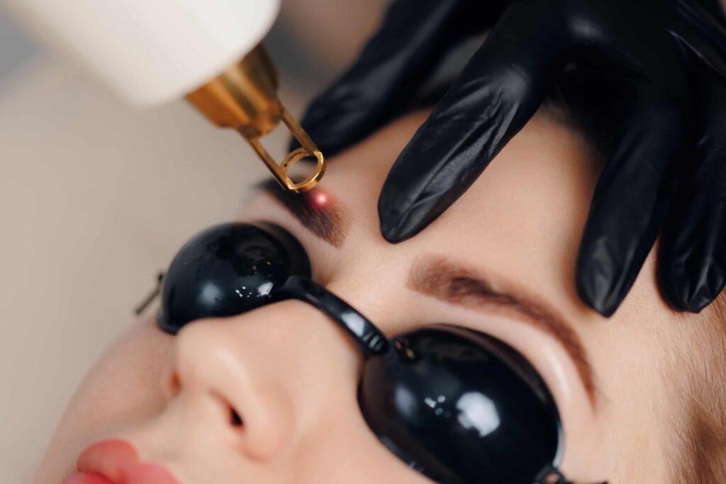 Permanent Makeup removal