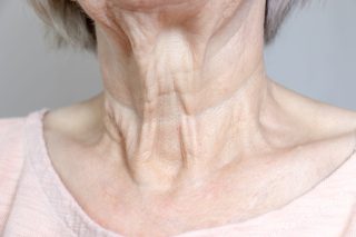 skin laxity treatment